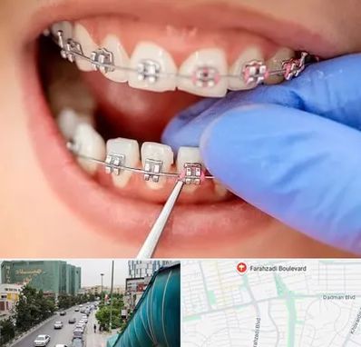 مرکز ارتودنسی دندان در بلوار فرحزادی