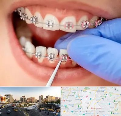 مرکز ارتودنسی دندان در منطقه 7 تهران