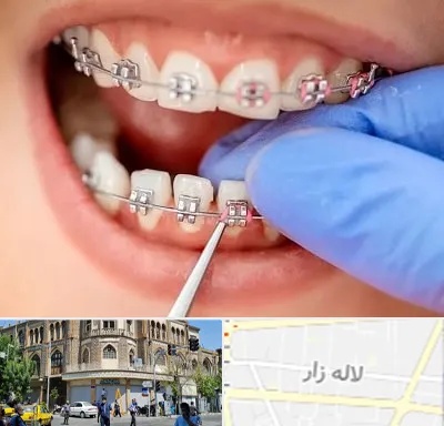 مرکز ارتودنسی دندان در لاله زار