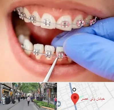 مرکز ارتودنسی دندان در ولیعصر شهریار