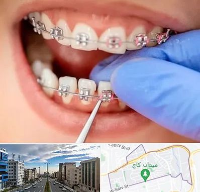 مرکز ارتودنسی دندان در سعادت آباد تهران