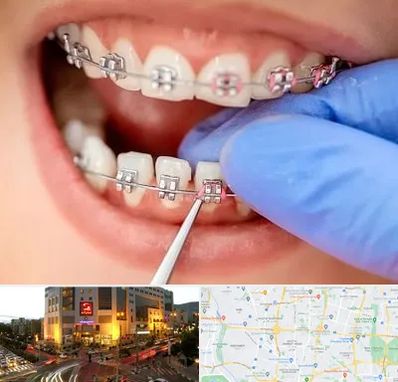 مرکز ارتودنسی دندان در جنت آباد تهران