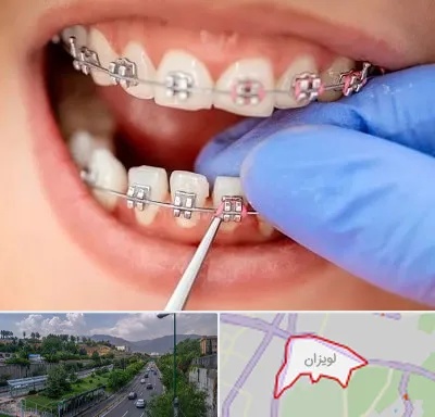 مرکز ارتودنسی دندان در لویزان