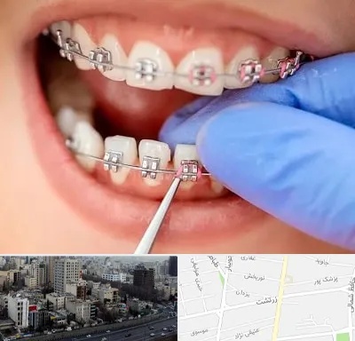 مرکز ارتودنسی دندان در زرتشت