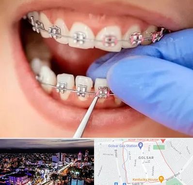 مرکز ارتودنسی دندان در گلسار رشت