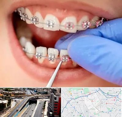 مرکز ارتودنسی دندان در ستارخان شیراز