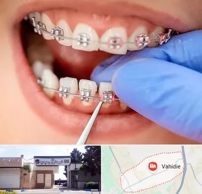 مرکز ارتودنسی دندان در وحیدیه شهریار