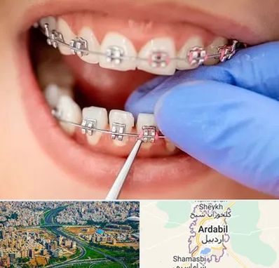 مرکز ارتودنسی دندان در اردبیل