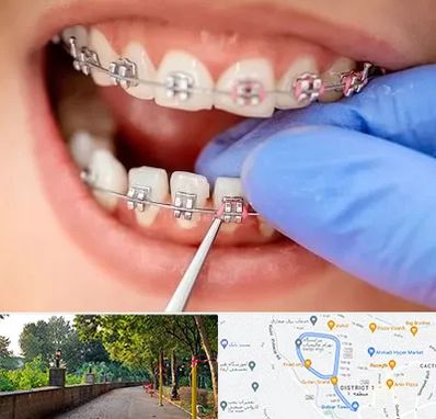 مرکز ارتودنسی دندان در فلکه گاز رشت