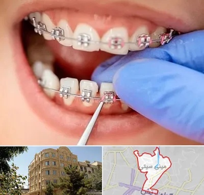 مرکز ارتودنسی دندان در مینی سیتی