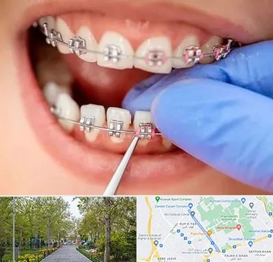 مرکز ارتودنسی دندان در قدوسی غربی شیراز