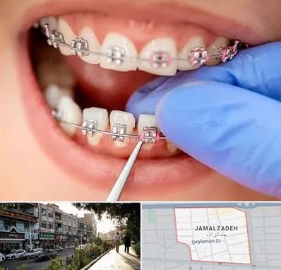 مرکز ارتودنسی دندان در خیابان جمالزاده