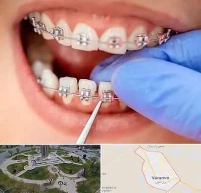 مرکز ارتودنسی دندان در ورامین
