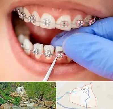 مرکز ارتودنسی دندان در کردان