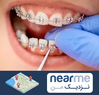 مرکز ارتودنسی دندان در نزدیک من