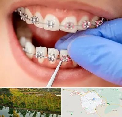 مرکز ارتودنسی دندان در بهبهان