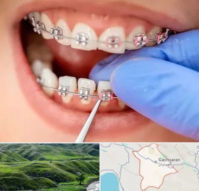 مرکز ارتودنسی دندان در گچساران