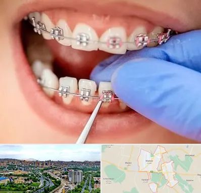 مرکز ارتودنسی دندان در شهریار