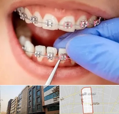 مرکز ارتودنسی دندان در نجات اللهی