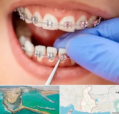 مرکز ارتودنسی دندان در سیستان و بلوچستان