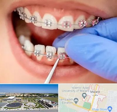 مرکز ارتودنسی دندان در ملارد