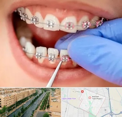 مرکز ارتودنسی دندان در فاز سه اندیشه
