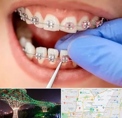 مرکز ارتودنسی دندان در منطقه 3 تهران