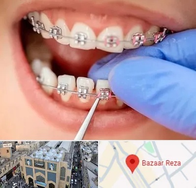 مرکز ارتودنسی دندان در بازار رضا مشهد