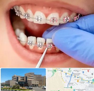 مرکز ارتودنسی دندان در صیاد شیرازی مشهد