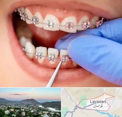مرکز ارتودنسی دندان در لواسان