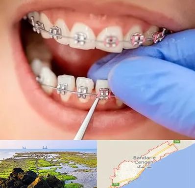 مرکز ارتودنسی دندان در بندرلنگه