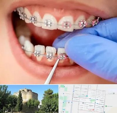 مرکز ارتودنسی دندان در مرداویج اصفهان