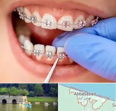مرکز ارتودنسی دندان در عباس آباد