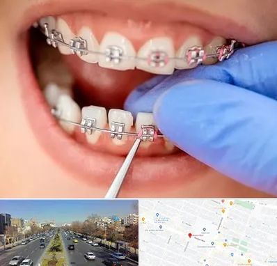 مرکز ارتودنسی دندان در بلوار معلم مشهد