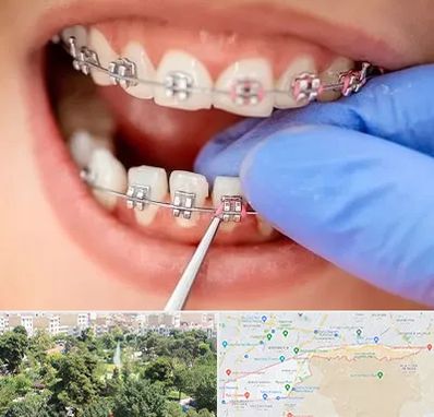 مرکز ارتودنسی دندان در منطقه 13 تهران