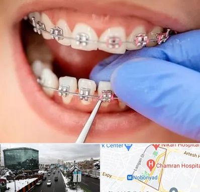 مرکز ارتودنسی دندان در اقدسیه