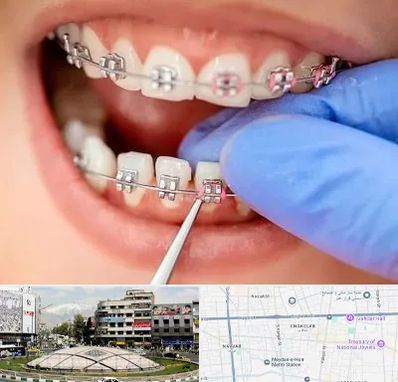 مرکز ارتودنسی دندان در مرکز تهران