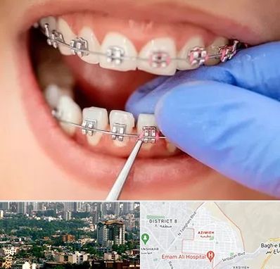 مرکز ارتودنسی دندان در عظیمیه کرج