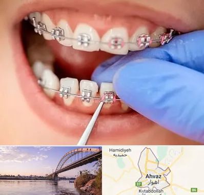 مرکز ارتودنسی دندان در اهواز