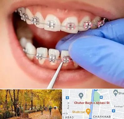 مرکز ارتودنسی دندان در چهارباغ اصفهان