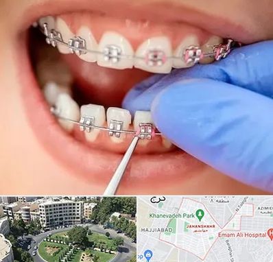 مرکز ارتودنسی دندان در جهانشهر کرج