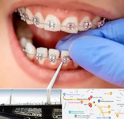 مرکز ارتودنسی دندان در پارک وی