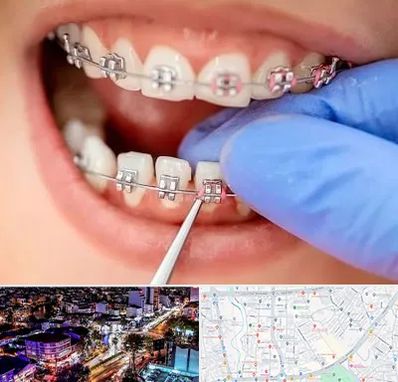 مرکز ارتودنسی دندان در منظریه رشت