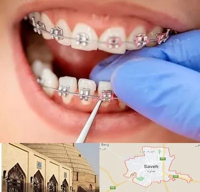 مرکز ارتودنسی دندان در ساوه