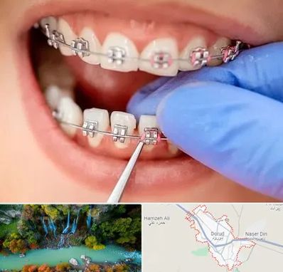 مرکز ارتودنسی دندان در دورود