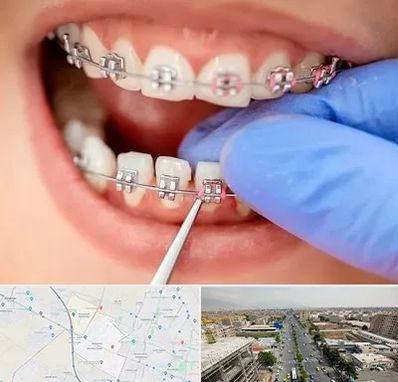 مرکز ارتودنسی دندان در حصارک کرج