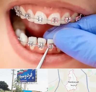 مرکز ارتودنسی دندان در فردوسیه شهریار
