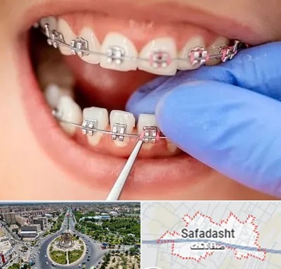 مرکز ارتودنسی دندان در صفادشت