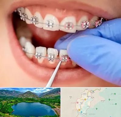 مرکز ارتودنسی دندان در رودبار