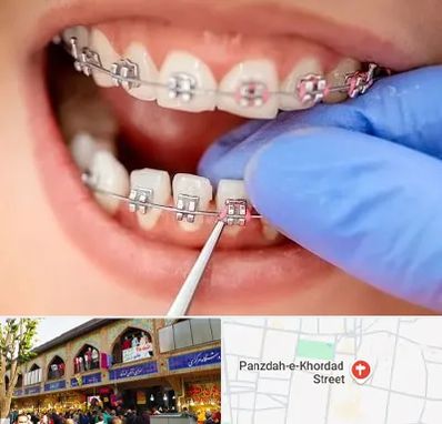 مرکز ارتودنسی دندان در 15 خرداد